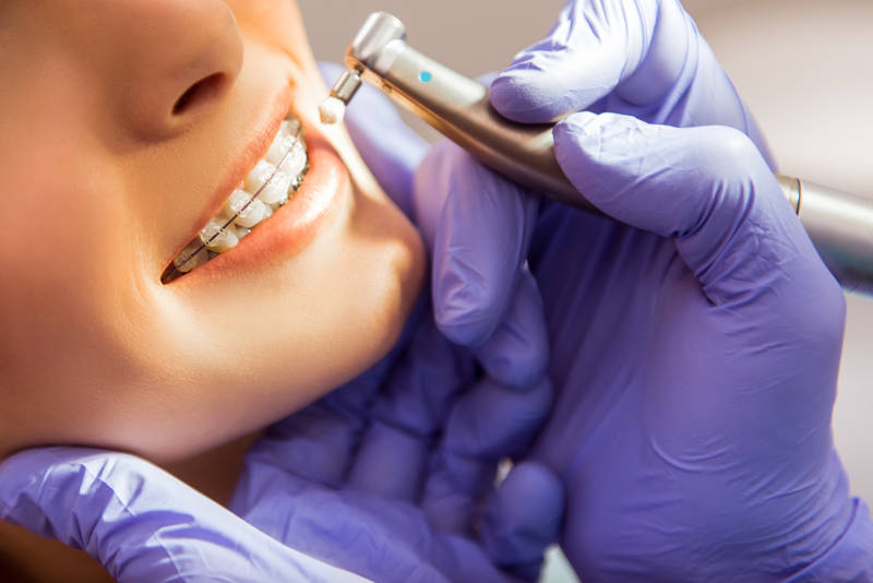cuidados ortodoncia
