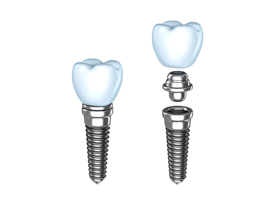 Cirugía oral e Implantología