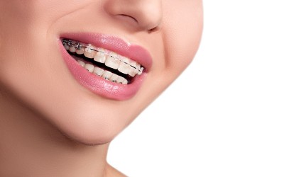 ¿Sabes de dónde viene y cómo funciona la ortodoncia?